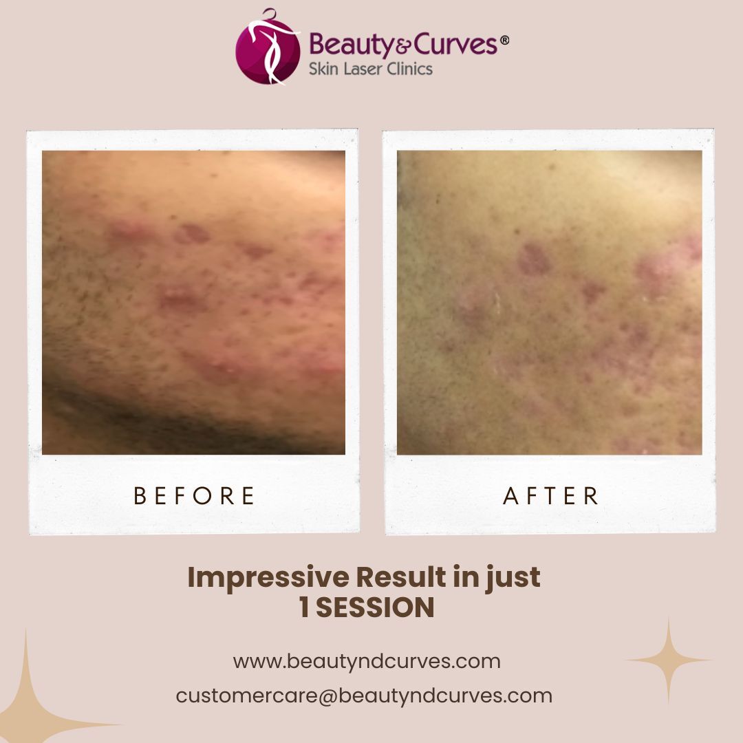 505739429_18490001695067573_2055901441875206323_n